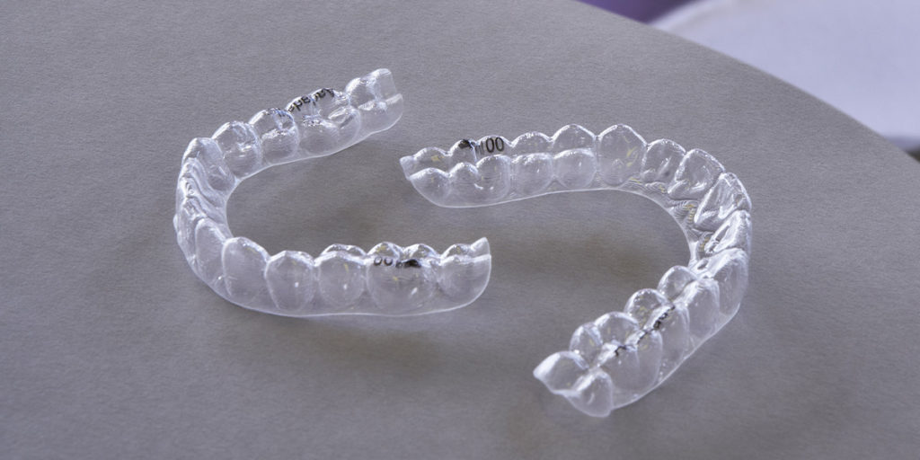 M Clarity Aligners Fresh Orthodontics